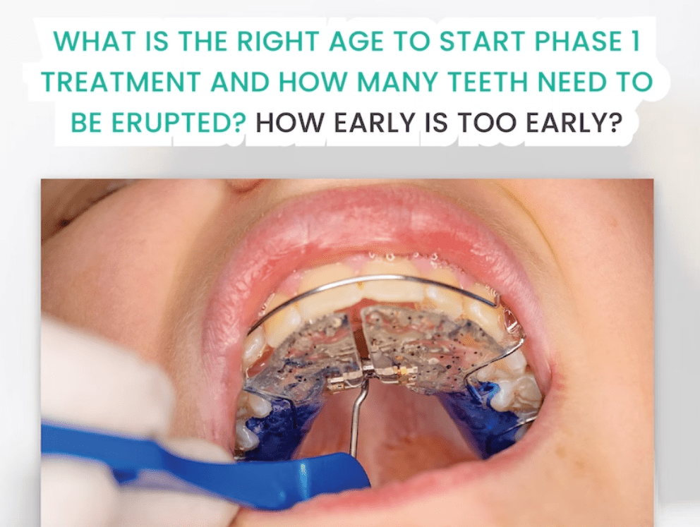 What is the Right Age to Start Phase 1 Orthodontic Treatment?