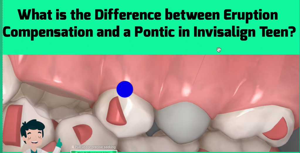 What is the Difference Between Eruption Compensation and a Pontic in ...