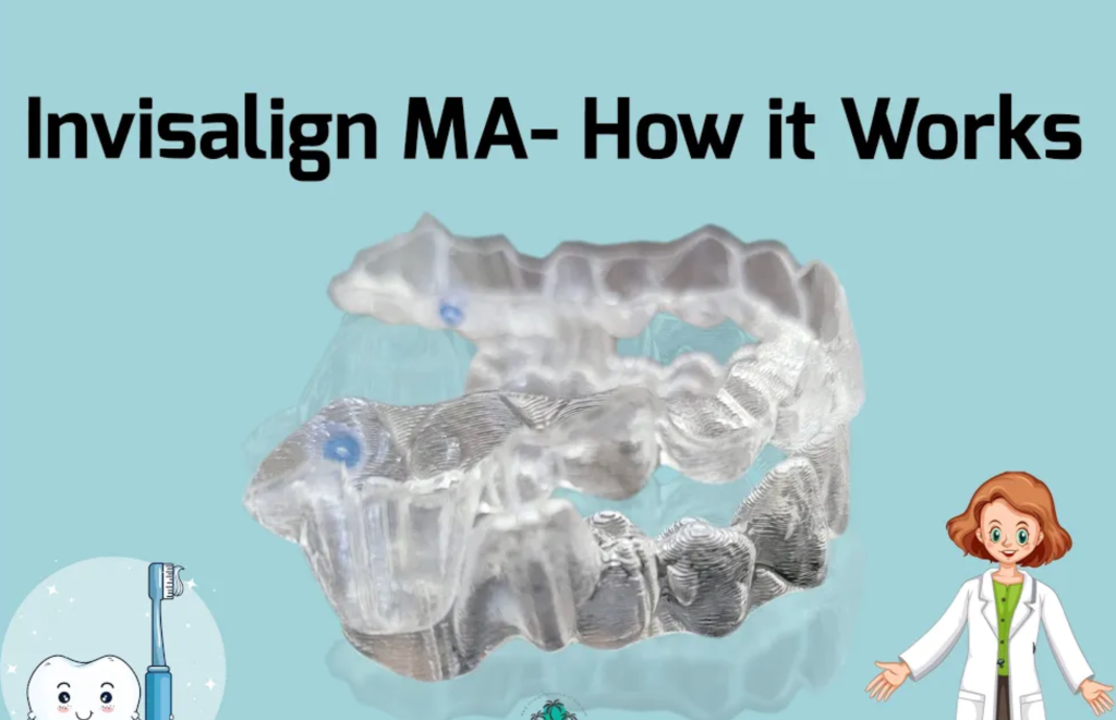 How Invisalign and Mandibular Advancement Work