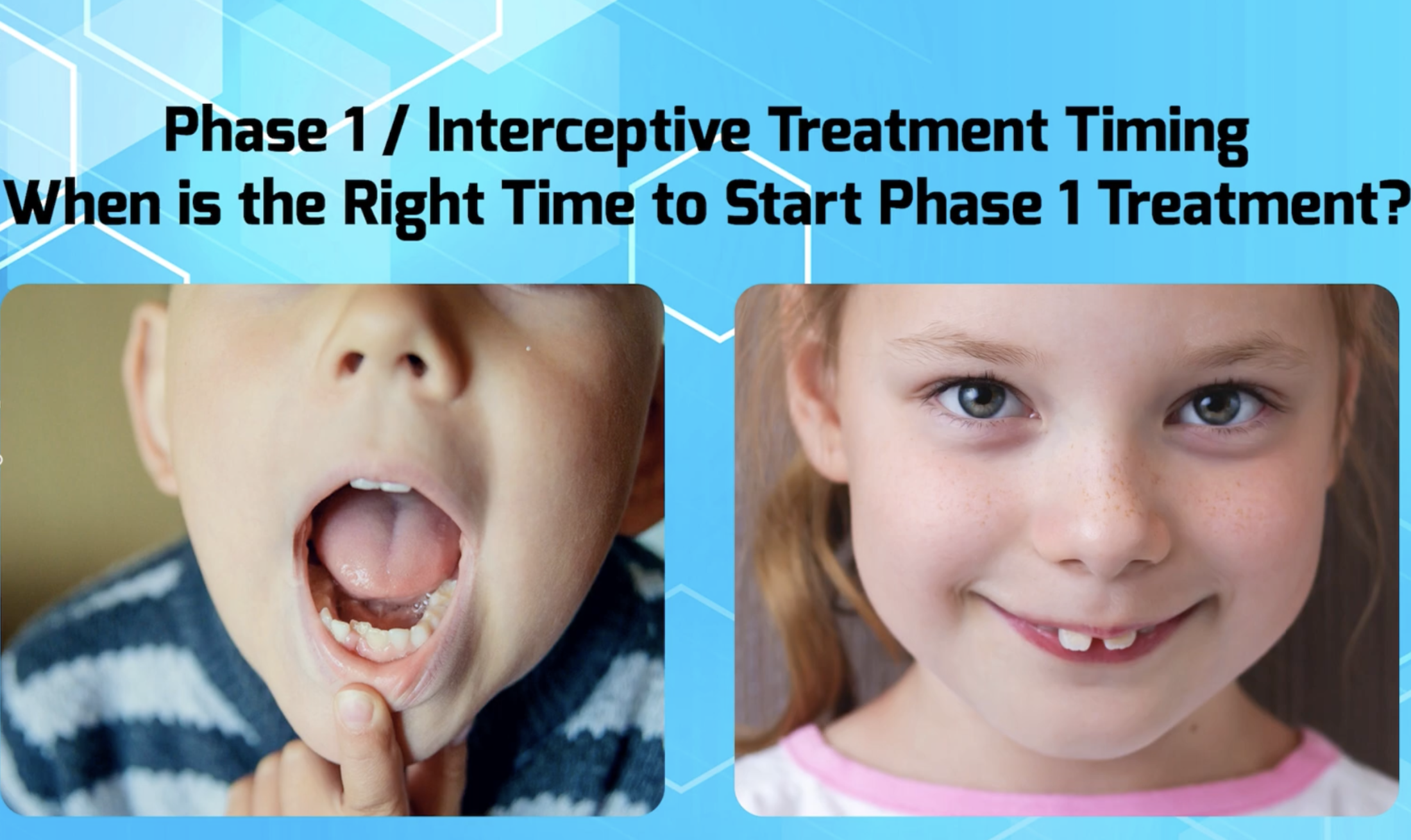 When to Start Phase 1 Interceptive Treatment