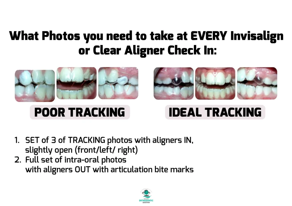 Invisalign Clean Check Taking Photos During Invisalign and Clear Aligner Check Ins