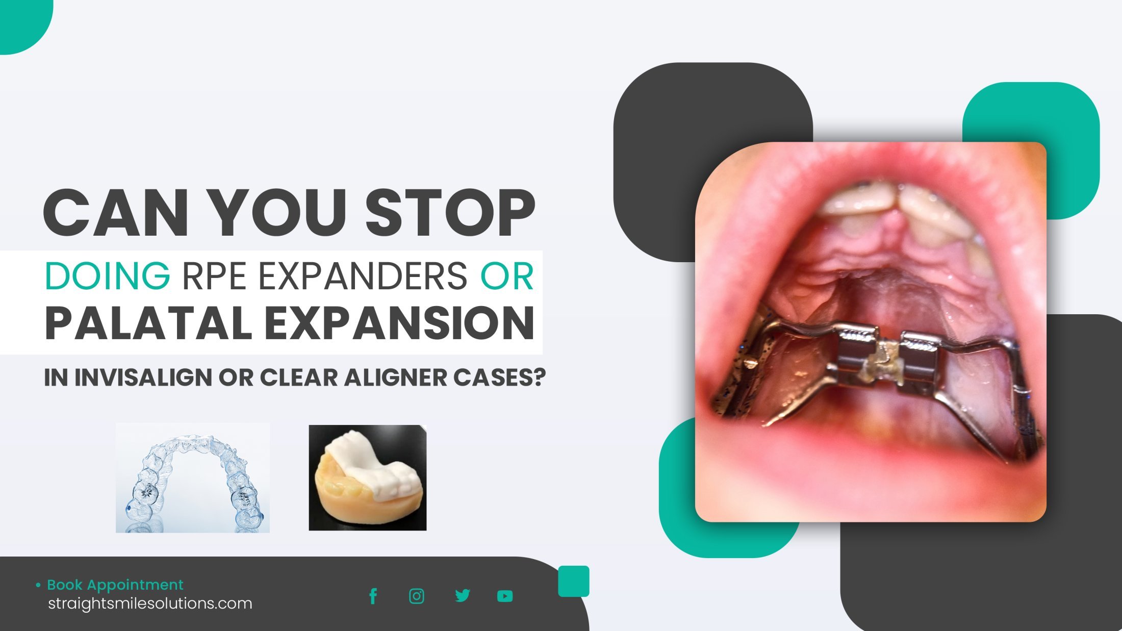 Invisalign for Palatal Expansion Cases