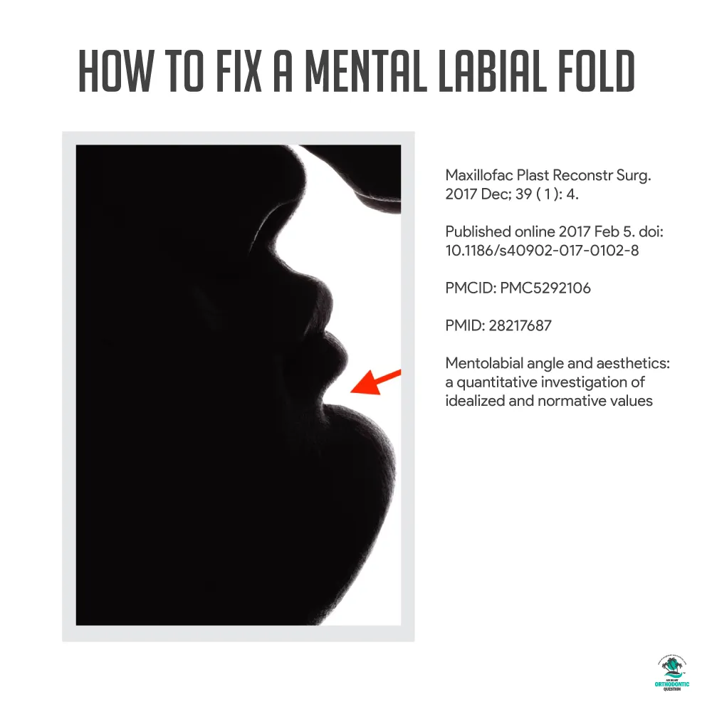 Labial Assimilation Fixing a Mental Labial Fold