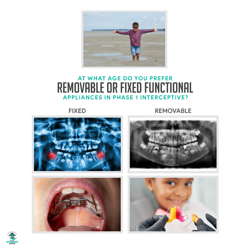 Fixed vs. Removable Expanders ( RPE vs. Schwartz )