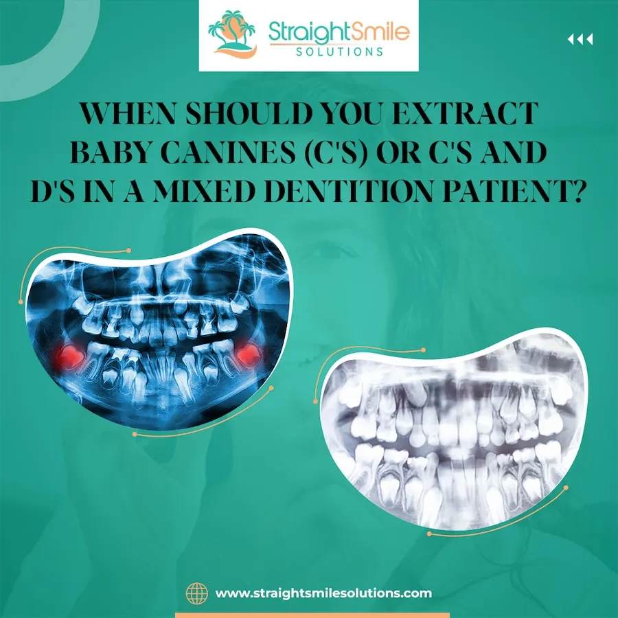 When Should You Take Out Baby Canine Teeth for Orthodontic Cases?