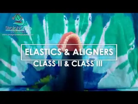 Precision Cuts Elastics and Rubberbands for Aligners Slots and Buttons Video Thumbnail