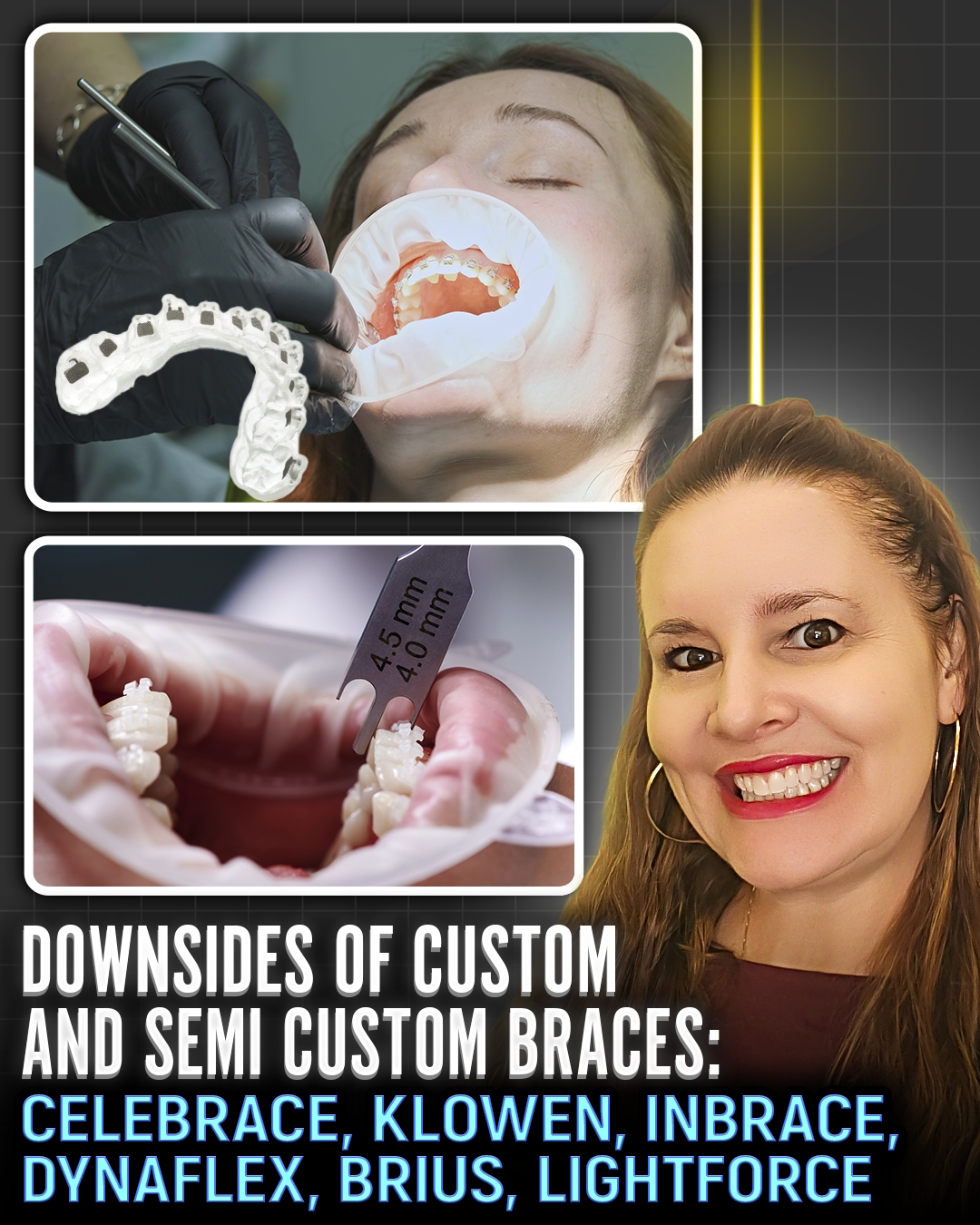klowen custom braces Buy KLOW 80mg | Where to Buy KLOW | Purgo Labs | Buy Peptides Online main image 0